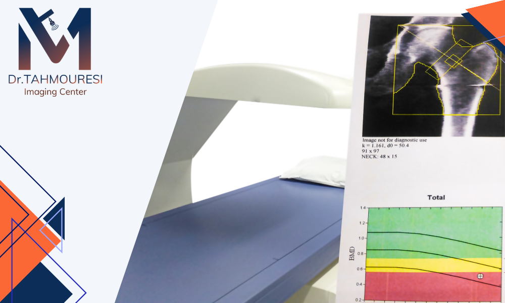 بهترین مرکز سنجش تراکم استخوان در فردیس کرج