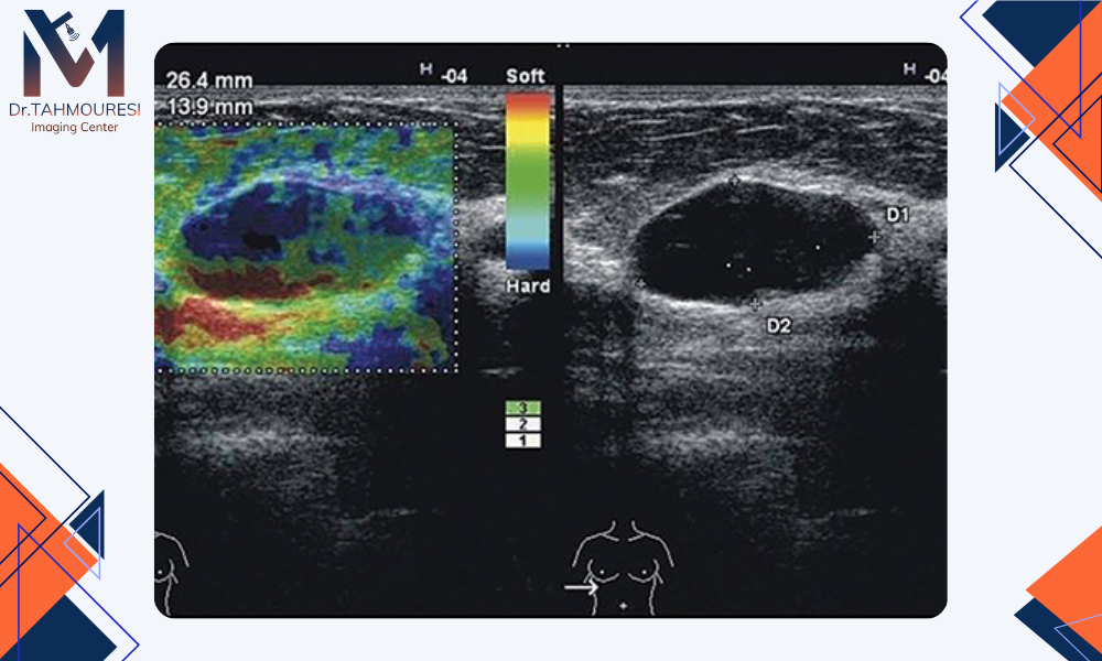 اصول کار elastography