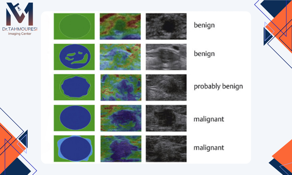تفسیر الاستوگرافی سینه 