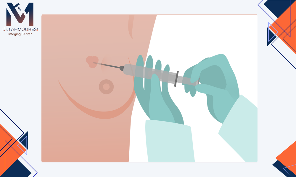 انواع بیوپسی برست 