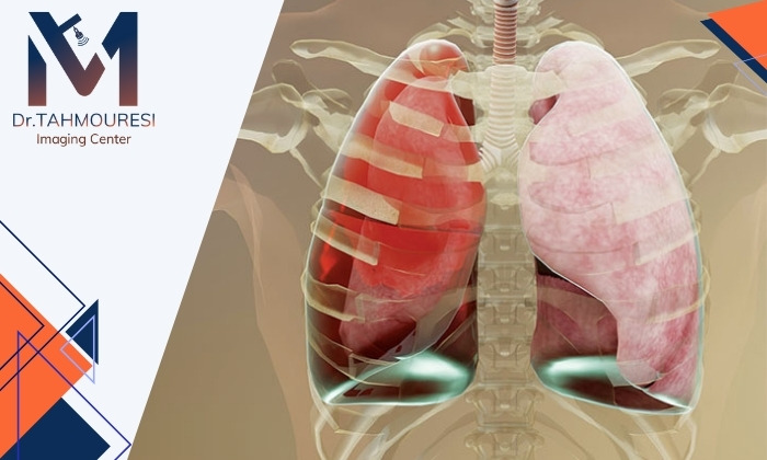 آیا نارسایی قلب باعث آب آوردن ریه می شود؟ بررسی روش های تشخیص