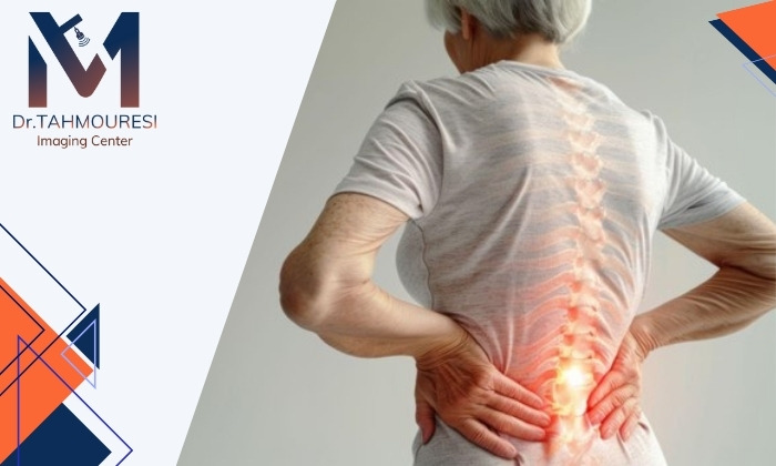 آیا کمردرد می‌تواند از پوکی استخوان باشد یا نه؟