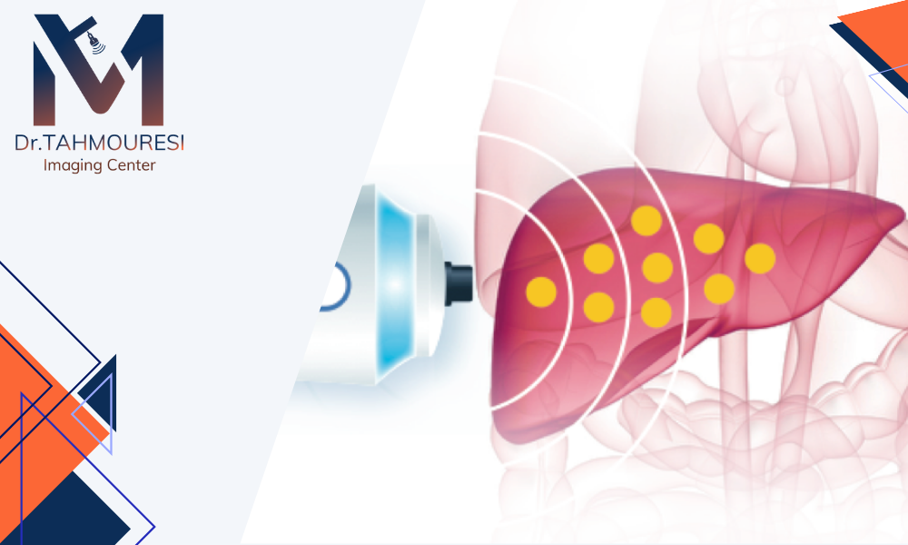 الاستوگرافی کبد در فردیس کرج با به روز ترین دستگاه 