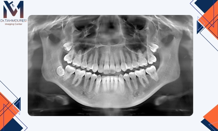 انواع رادیولوژی‌ دندانی