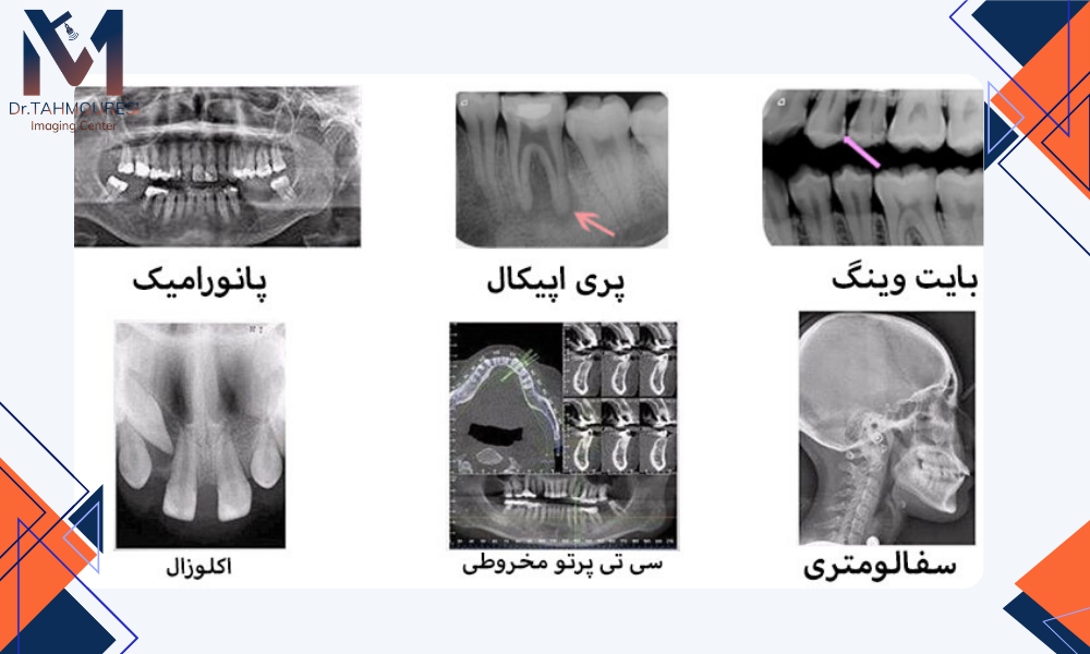 انواع عکس‌های دندانی 