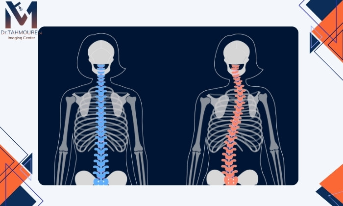 اهمیت تشخیص زودهنگام