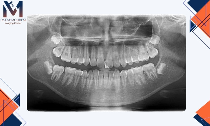روشهای تشخیص علت درد روشهای تشخیص علت درد