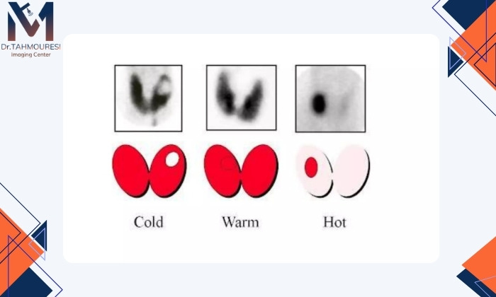 روشهای تشخیص روشهای تشخیص