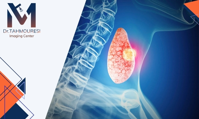 تفاوت ندول سرد و گرم تیروئید چیست؟ تفاوت ندول سرد و گرم تیروئید چیست؟