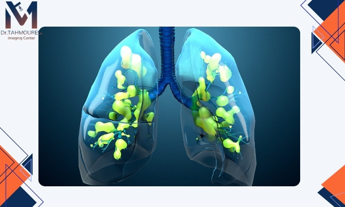 تفاوت ذات‌الریه با سایر بیماری‌های ریوی در عکس