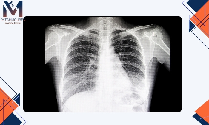 روش های تشخیص پنومونی