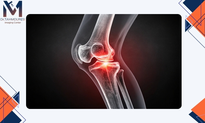 روش‌های تشخیص منشا صدا