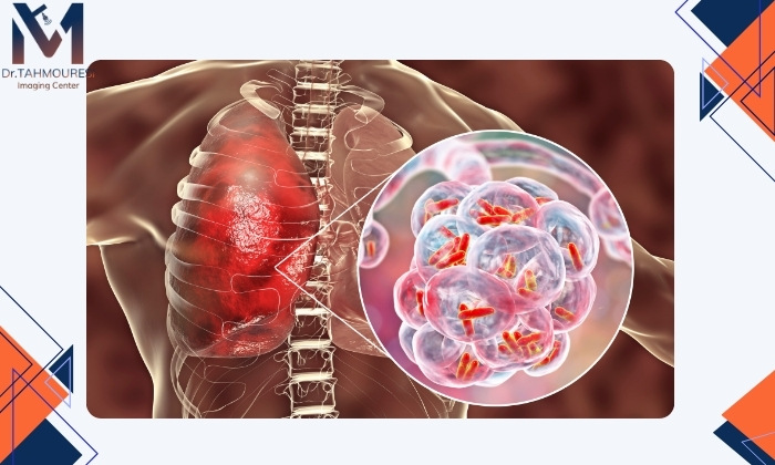 روش‌های پیشگیری از ذات‌الریه