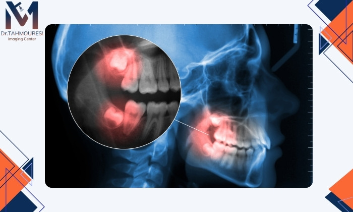 شرایطی که جراحی ضروری نیست شرایطی که جراحی ضروری نیست