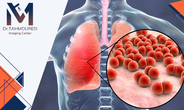 علائم پنومونی چیست و چگونه میتوان آن را تشخیص داد؟
