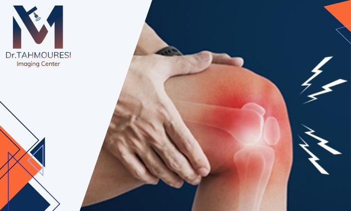 علت صدا دادن مفصل زانو هنگام خم شدن چیست؟ علت صدا دادن مفصل زانو هنگام خم شدن چیست؟