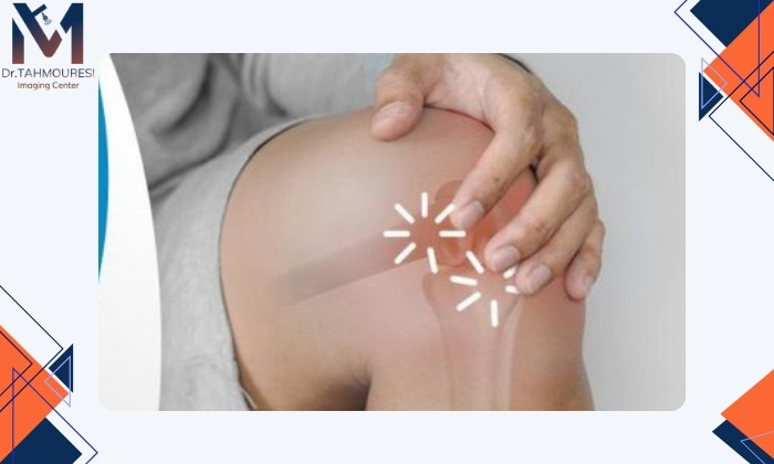 علل صدا دادن مفصل زانو هنگام خم شدن علل صدا دادن مفصل زانو هنگام خم شدن