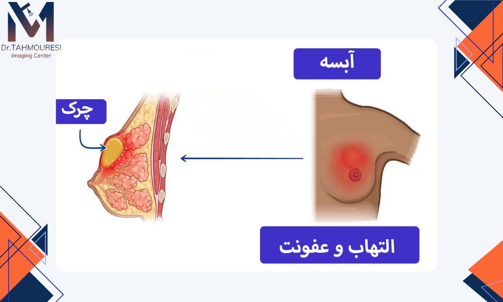 عوارض رایج تخلیه آبسه
