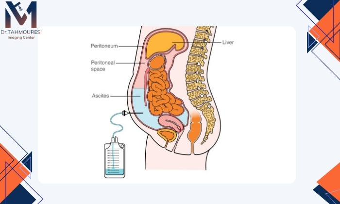 مراحل انجام این روش مراحل انجام این روش