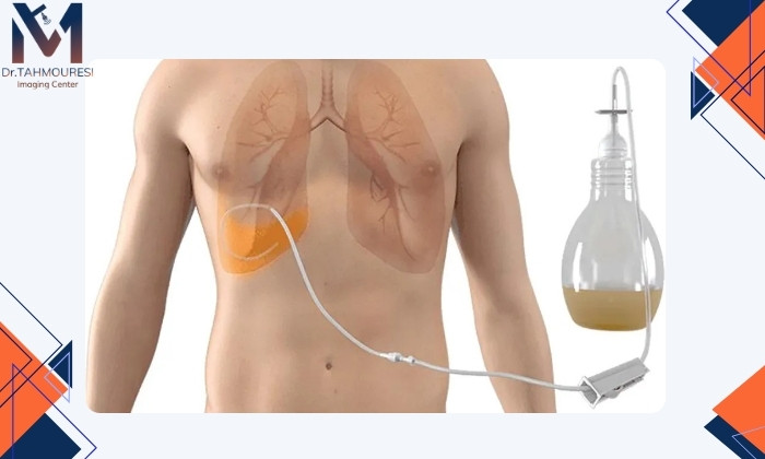 مراحل انجام