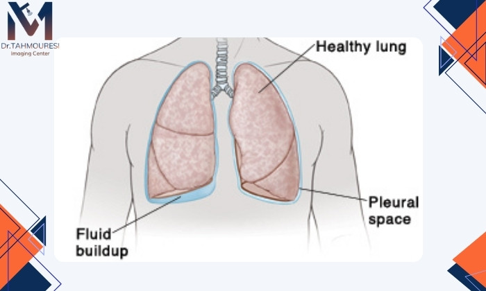 مراقبت‌های پس از لوله‌گذاری