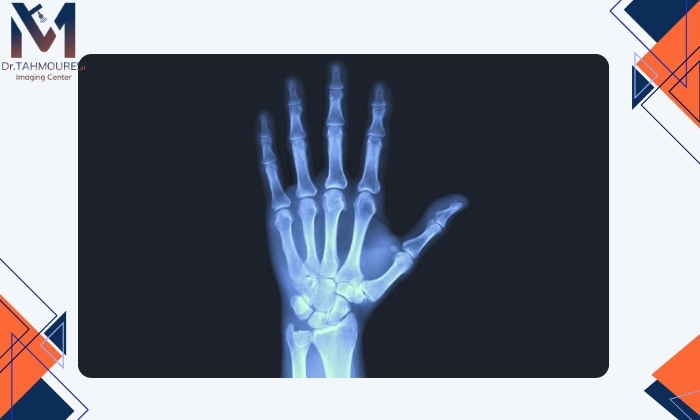 مواردی که رادیولوژی شکستگی را نشان نمی‌دهد