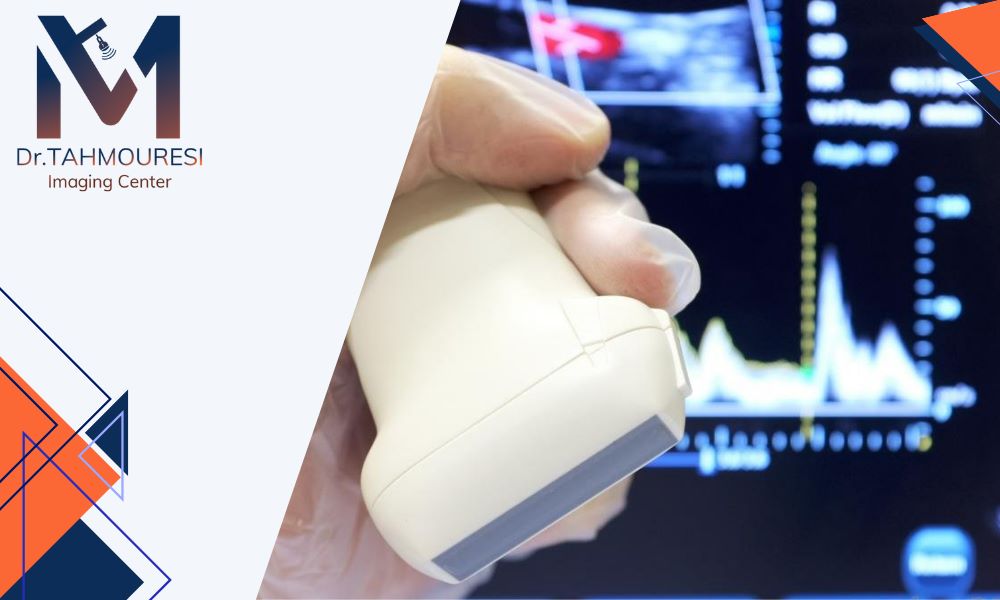 نقش سونوگرافی داپلر در تشخیص مشکلات عروقی چیست؟ نقش سونوگرافی داپلر در تشخیص مشکلات عروقی چیست؟