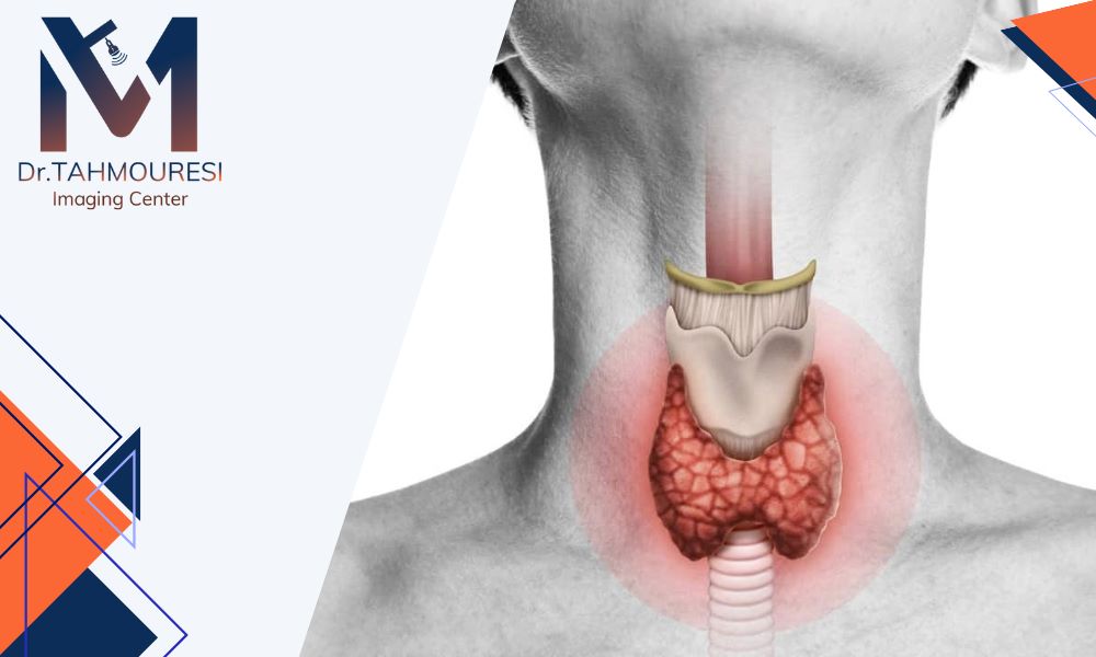 نمونه برداری تیروئید در فردیس کرج توسط پزشک متخصص و حاذق