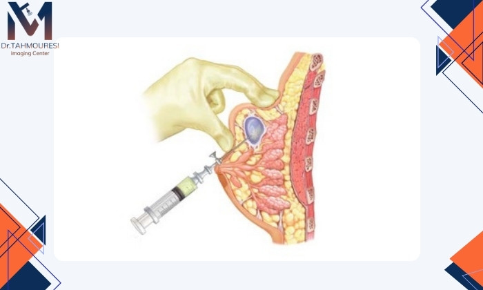 چه زمانی تخلیه ضروری است؟