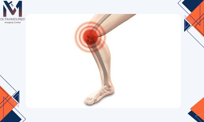 چه زمانی صدا دادن مفصل زانو طبیعی است؟ چه زمانی صدا دادن مفصل زانو طبیعی است؟