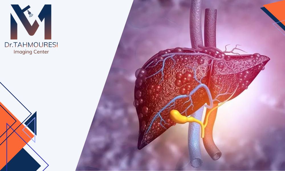 الاستوگرافی کبد چیست و چرا اهمیت دارد؟