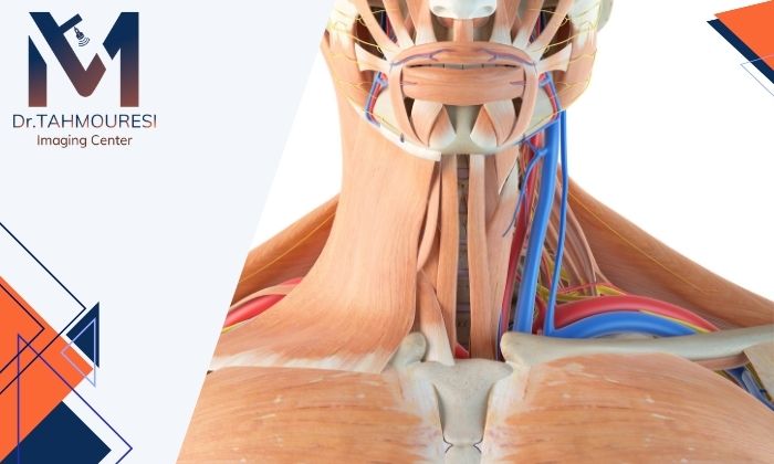 تنگی عروق گردن چه علائمی دارد و چگونه تشخیص داده می‌شود؟
