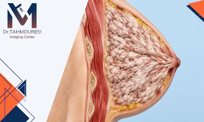 پستان متراکم در ماموگرافی یعنی چه و قدم بعدی چیست؟ پستان متراکم در ماموگرافی یعنی چه و قدم بعدی چیست؟